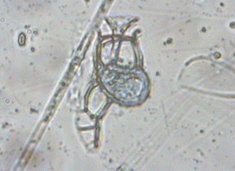Dictyocha speculum